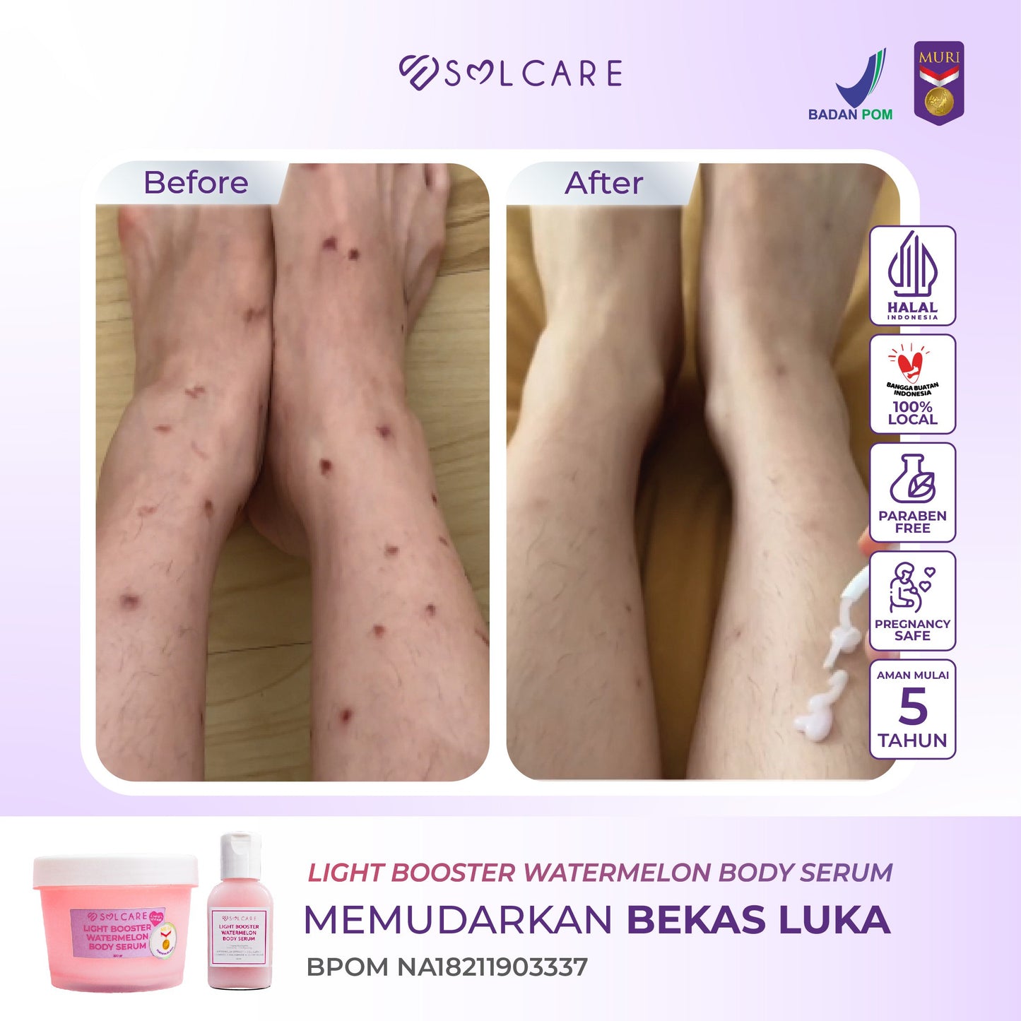 Solcare Bundling Watermelon Series - Body serum + Toner