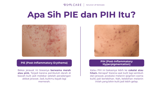 perbedaan PIE dan PIH