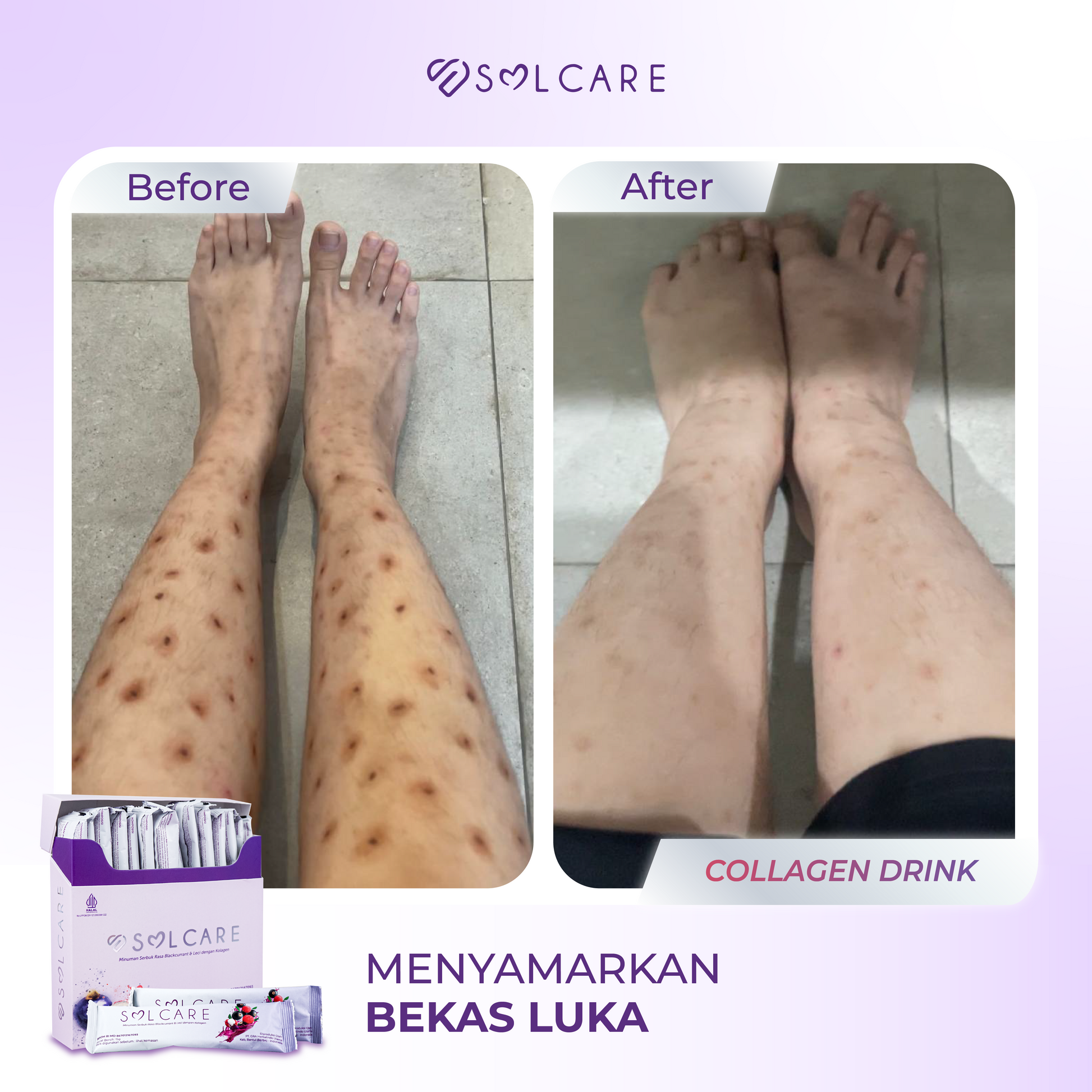 Collagen Drink before-after kaki