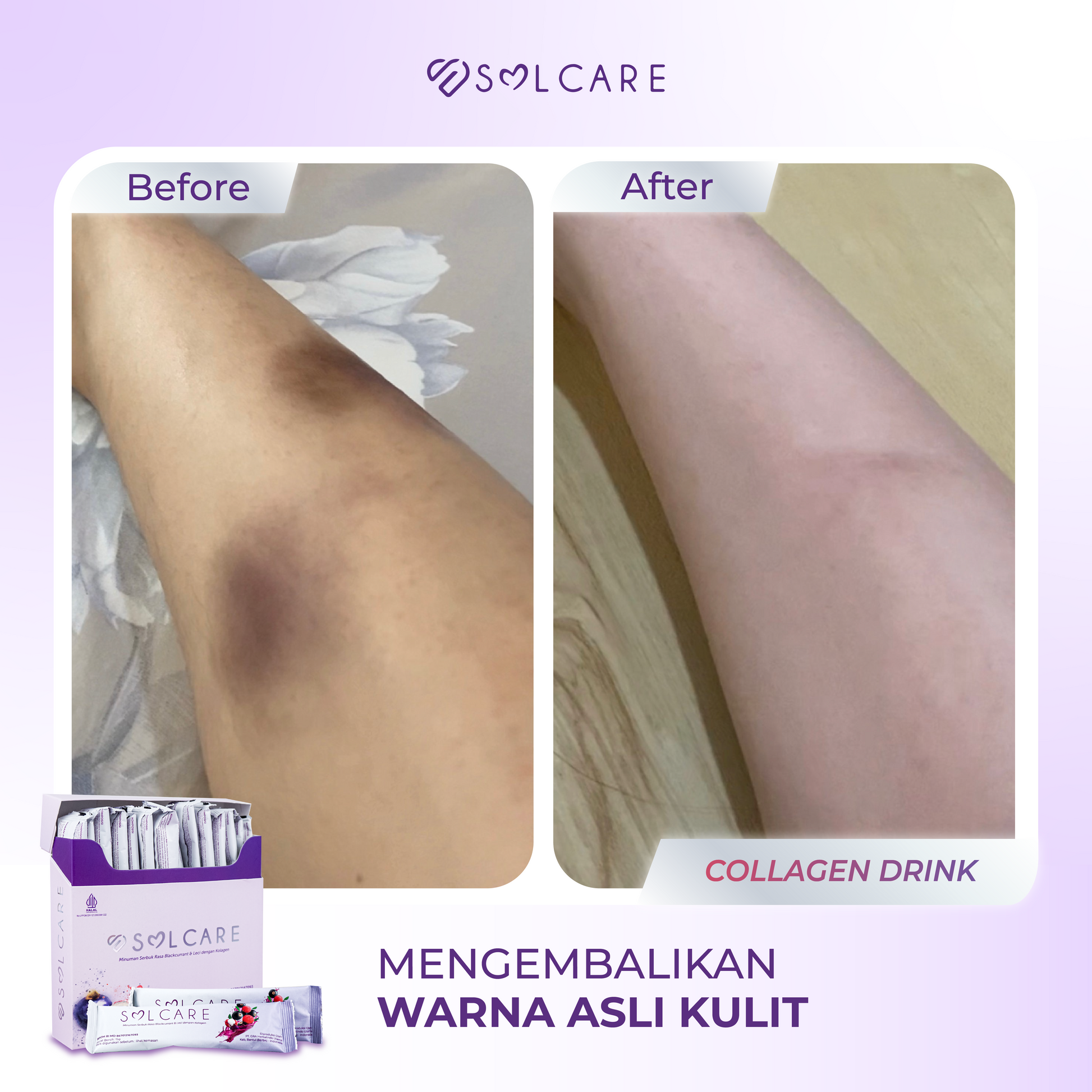 Collagen Drink before after