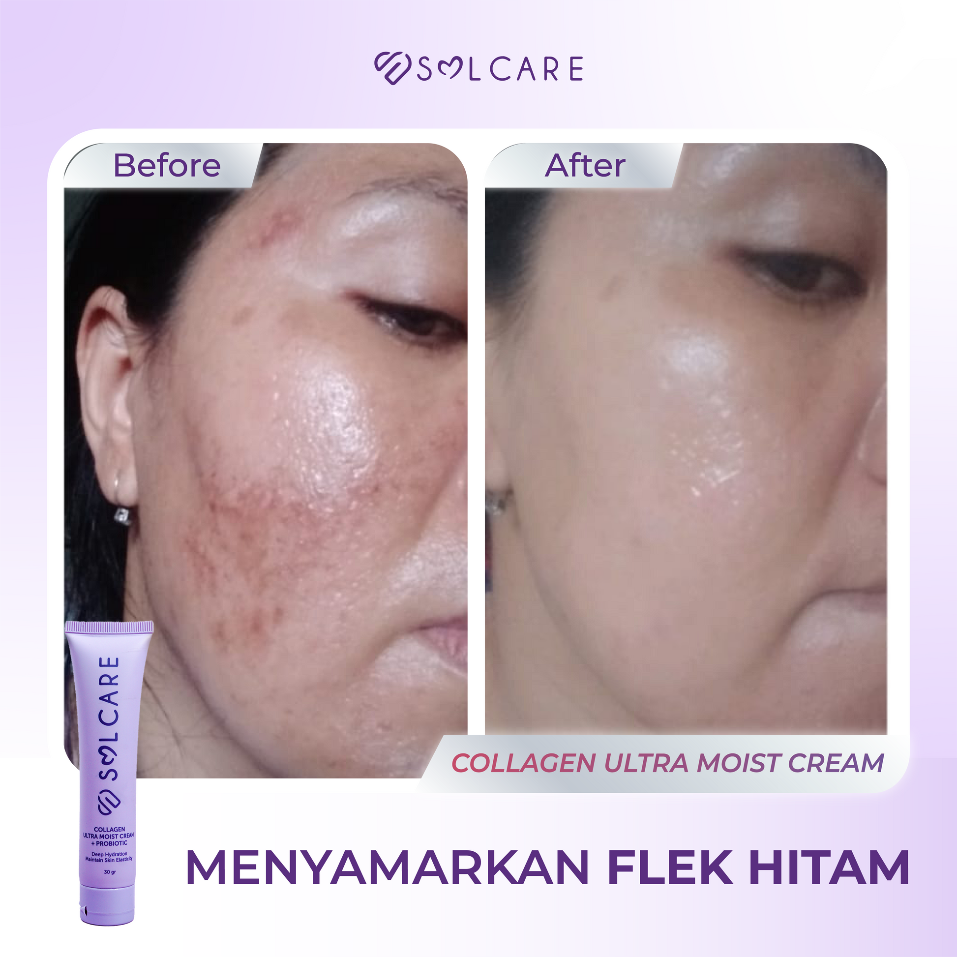 Collagen Cream Menyamarkan Flek Hitam