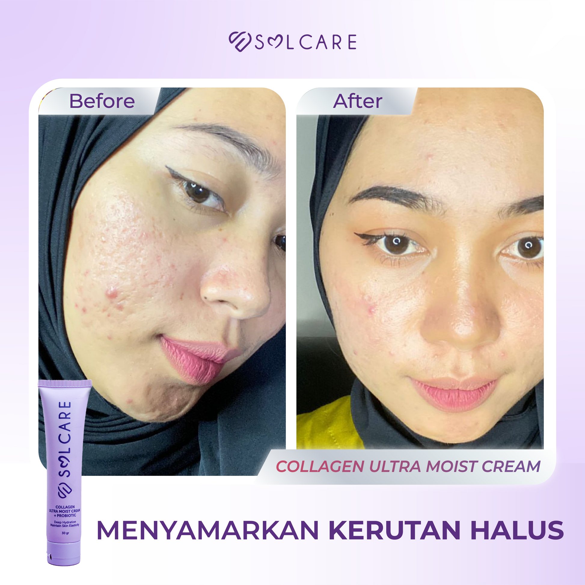 Collagen Cream Menyamarkan Kerutan Halus