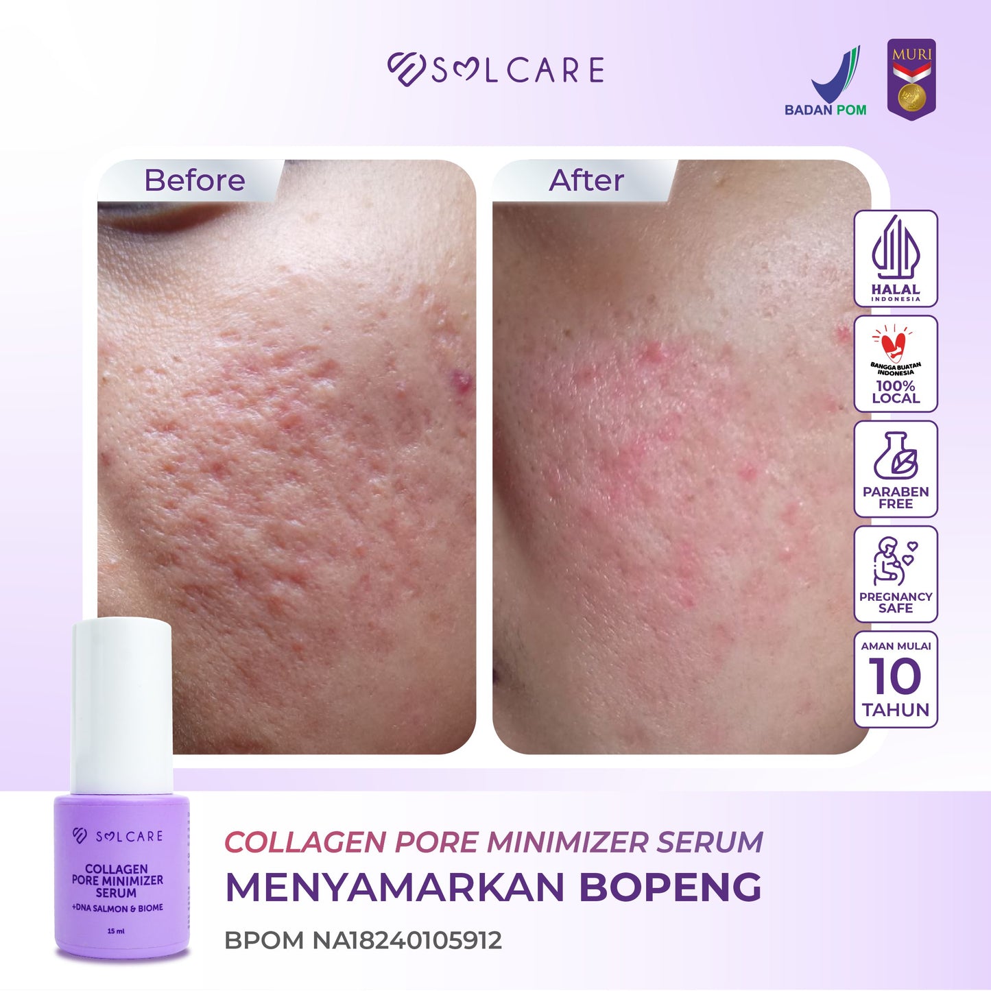 Collagen Pore Minimizer Serum + DNA Salmon & Biome