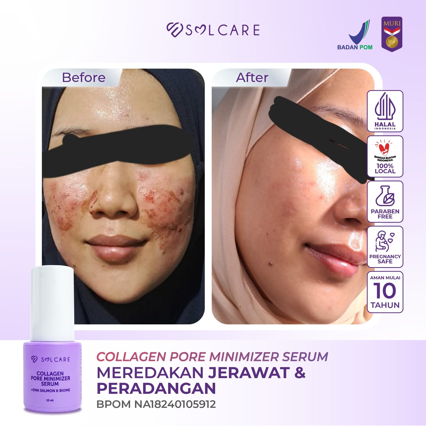 Collagen Pore Minimizer Serum + DNA Salmon & Biome