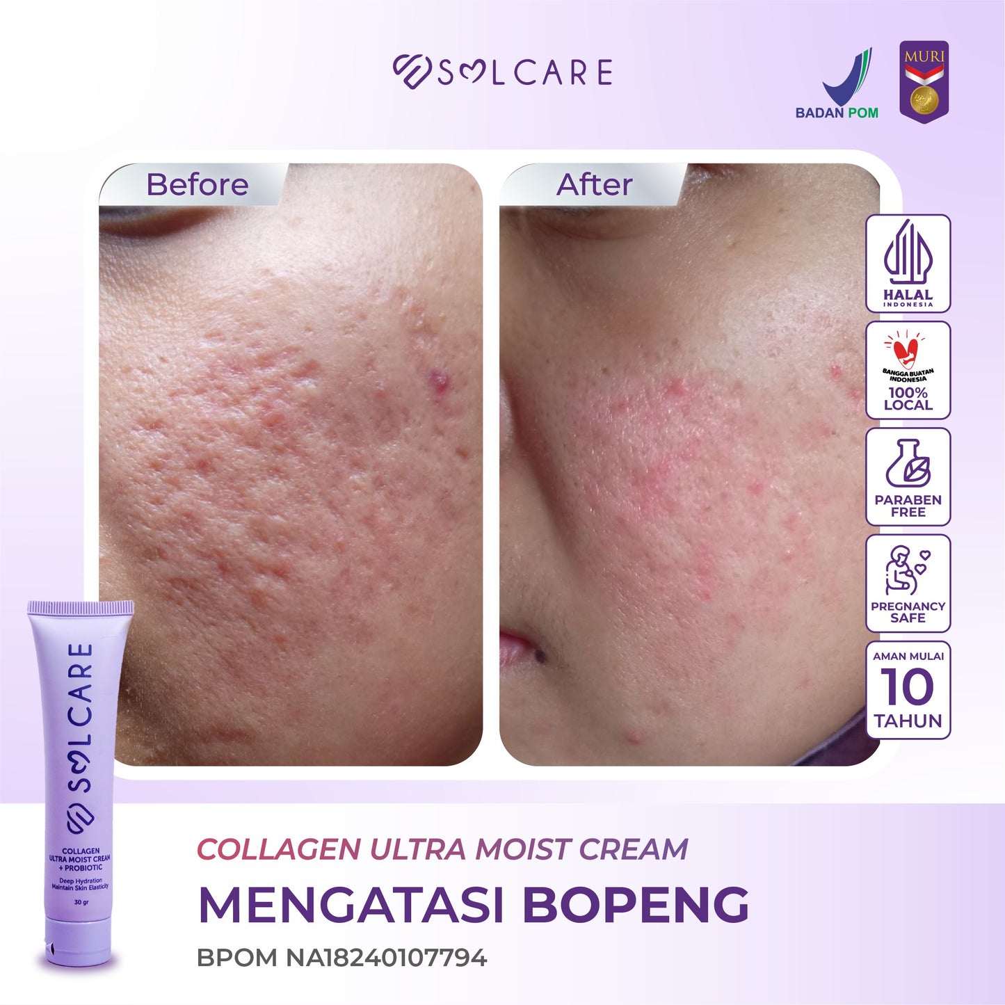 Collagen Ultra Moist Cream + Probiotic – Cream Penghilang Flek