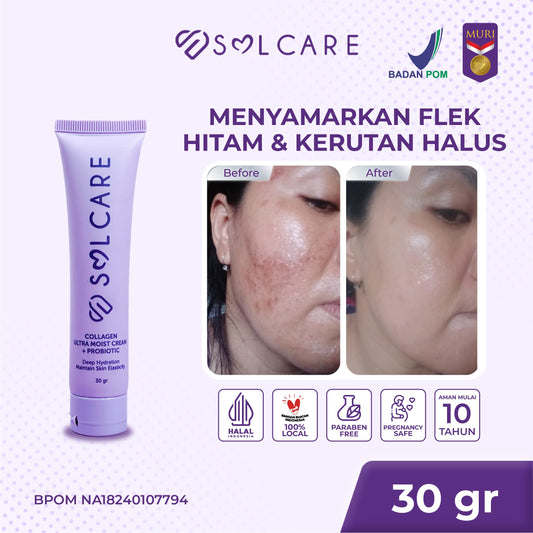 Collagen Ultra Moist Cream + Probiotic – Cream Penghilang Flek