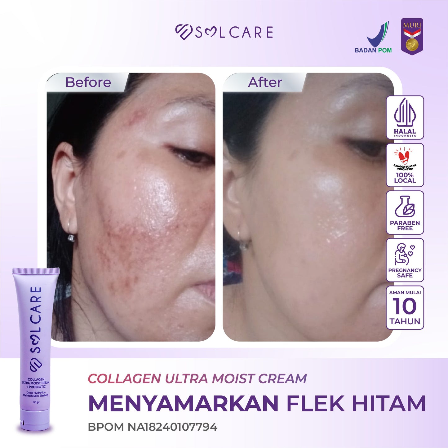 Collagen Ultra Moist Cream + Probiotic – Cream Penghilang Flek