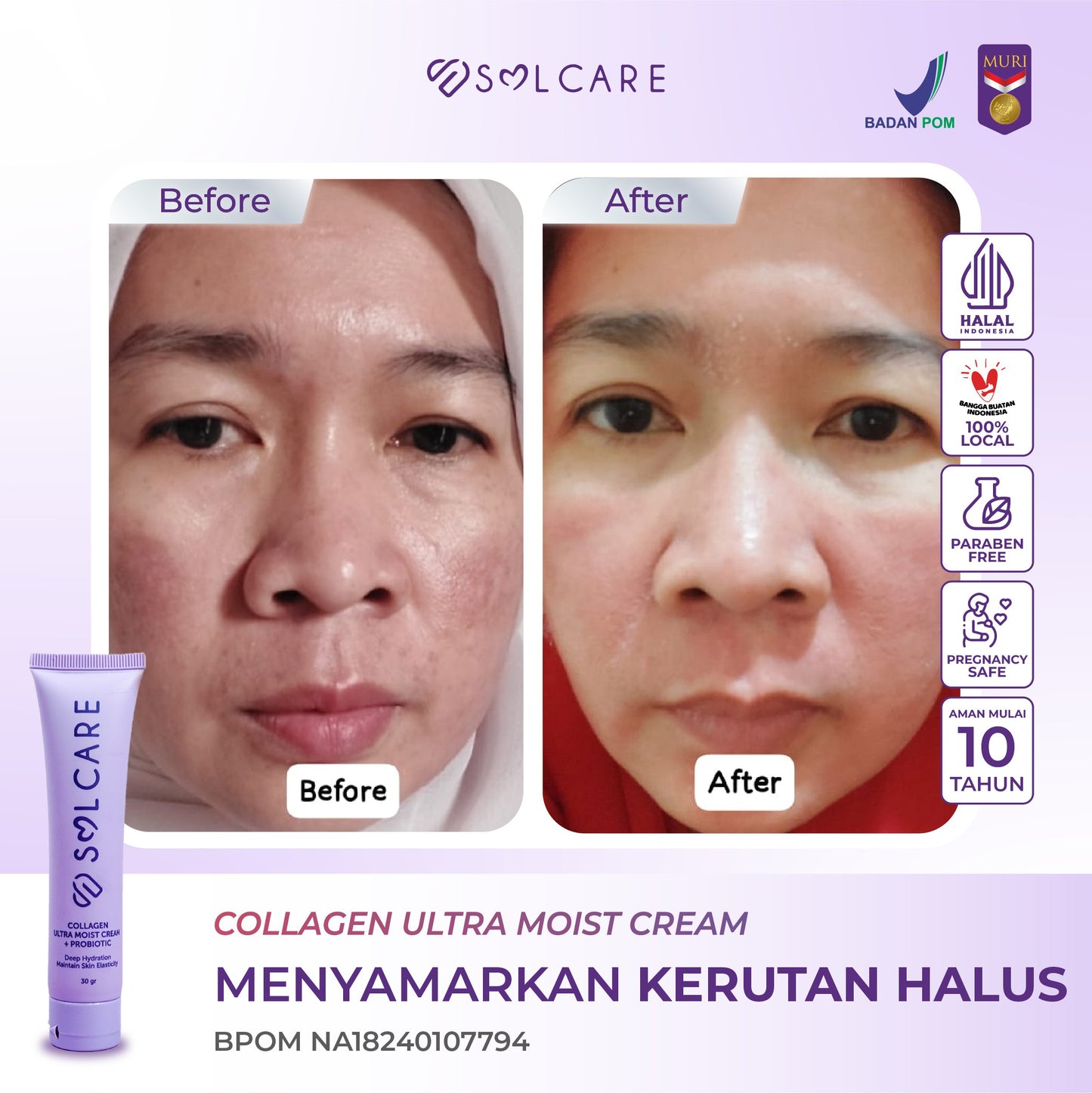 Collagen Ultra Moist Cream + Probiotic – Cream Penghilang Flek